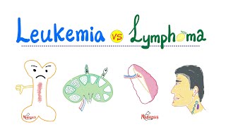 Chronic Lymphocytic Leukemia CLL Peripheral Blood Smear Hemepath Hematology Pathology [upl. by Ainna491]