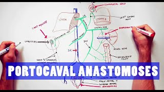 Portocaval Anastomoses  ANATOMY Tutorial [upl. by Yelrehs]