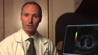 EBUS Basics and Mediastinal Staging  BAVLS [upl. by Ordnajela]