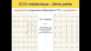 12b ECG métabolique 2 Hyperkaliémie et Hypokaliémie Dr Taboulet [upl. by Aliuqet524]